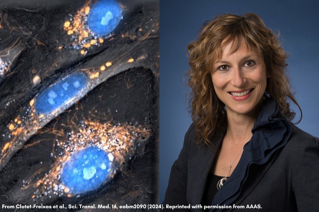 The left-hand panel has microscope images of kidney cells. The right-hand panel has a head-and-shoulders photo of Dr. Ana Konvalinka.